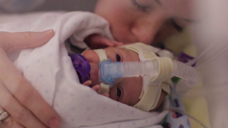 Prva godina života prerano rođene bebe