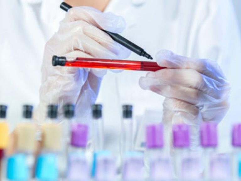 Laboratorijske pretrage u trudnoći